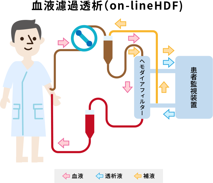 科學(xué)家改變沸石的特性以改善血液透析